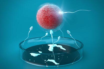 体外受精 IVF-ET